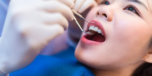 インビザラインのデメリット