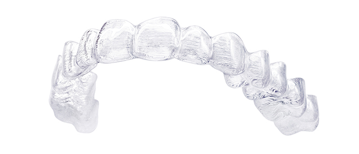 インビザラインの魅力